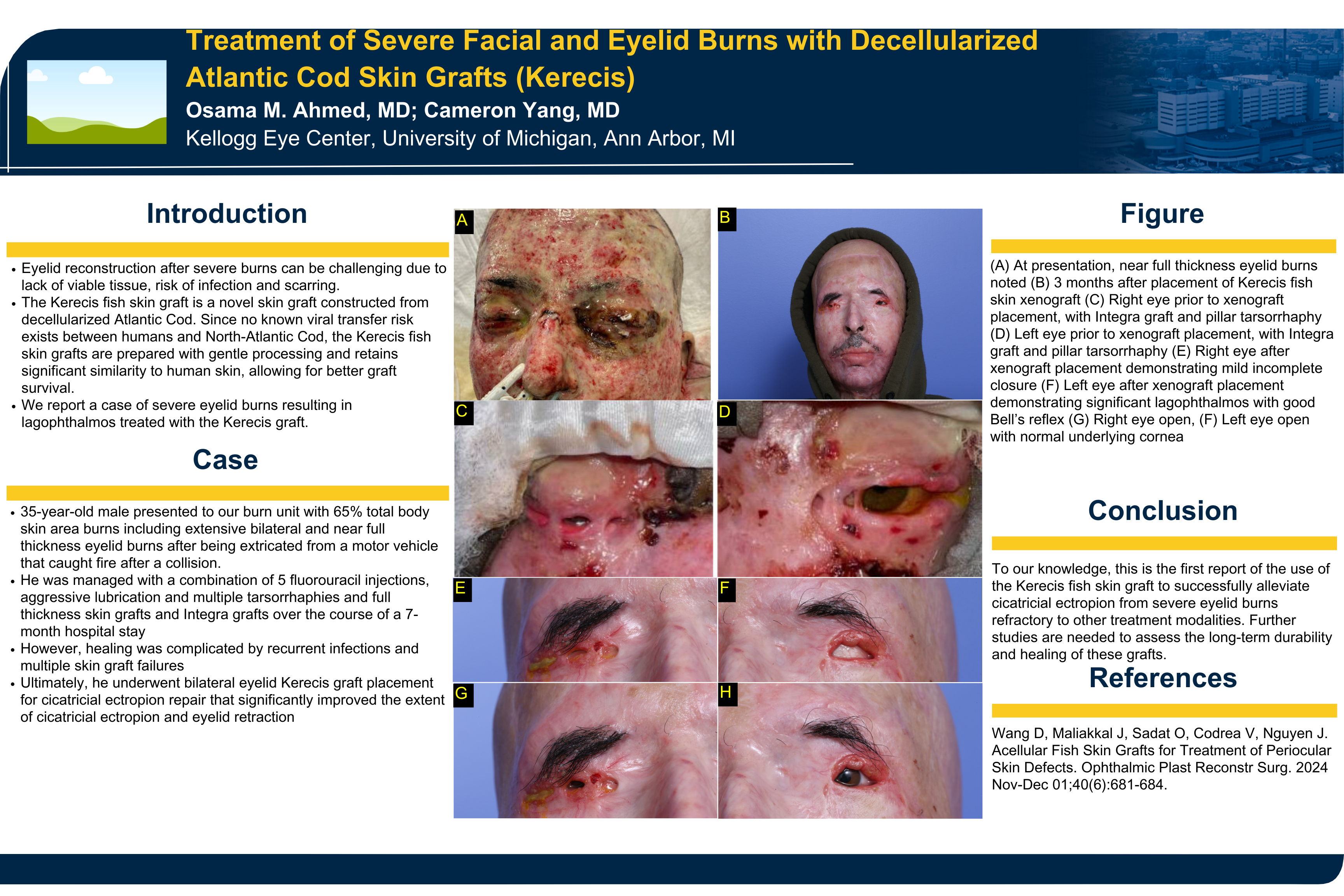 Kerecis poster.pptx (1)